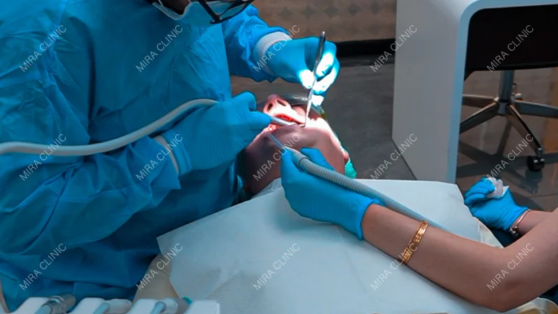 Zirconium Bridge Chef Mike Smile Plan